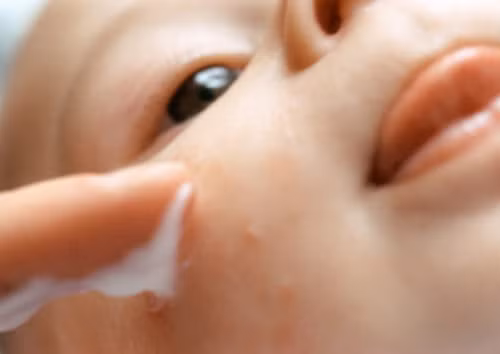Phải làm gì khi trẻ sơ sinh bị viêm kết mạc? ảnh 3