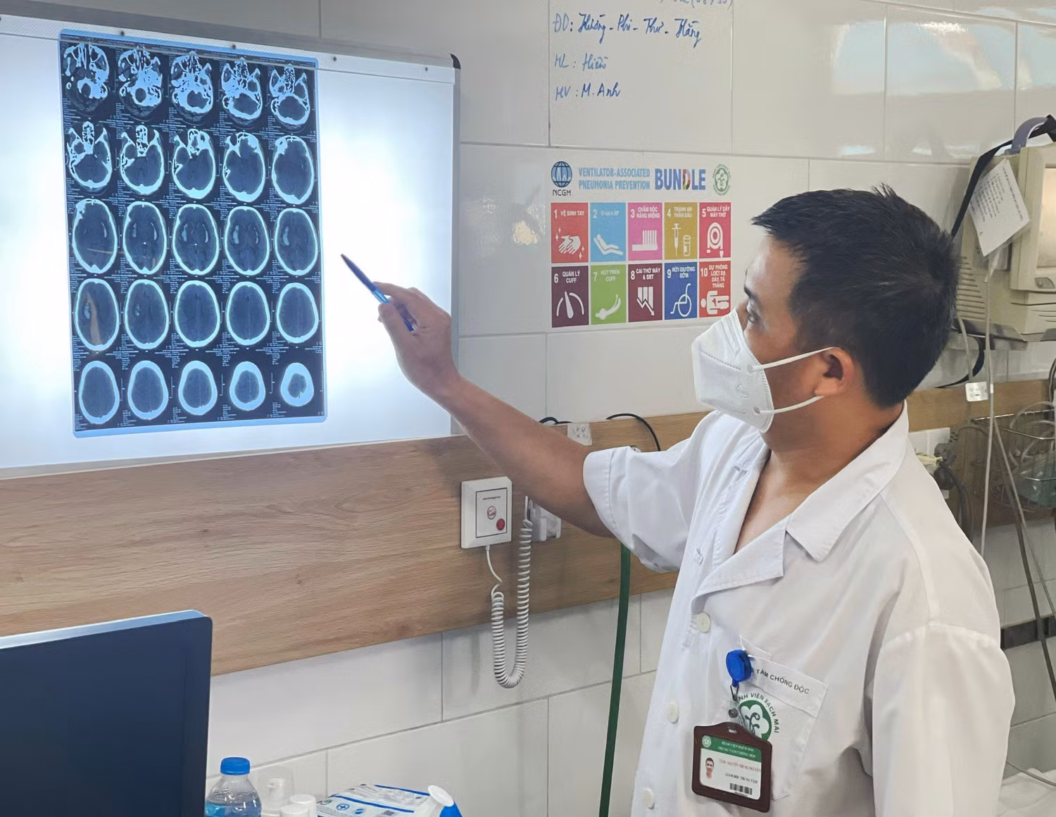 Bác sỹ Nguyễn Trung Nguyên - Giám đốc Trung tâm chống độc Bệnh viện Bạch Mai cho biết, nhiều bệnh nhân tổn thương não do ngộ độc cồn methanol.