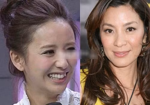 Khuyết điểm lớn nhất trên gương mặt Đồng Lệ Á là có quá nhiều nếp nhăn ở vùng mắt khiến cô trông già hơn tuổi rất nhiều, thậm chí "sánh bằng" cả Dương Tử Quỳnh.