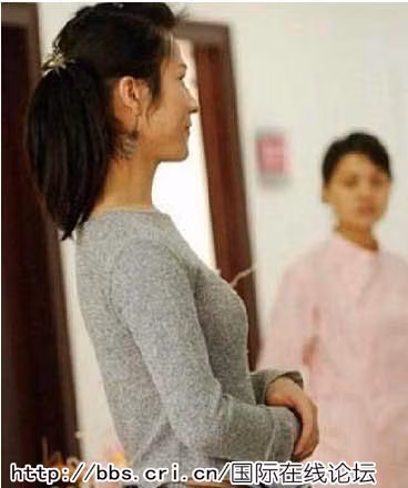 Sau một thời gian phẫu thuật, phần ngực đã lộ rõ. Sau một thời gian phẫu thuật, phần ngực đã lộ rõ.