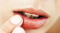 Lời khuyên về cách chăm sóc đôi môi của bạn ảnh 3