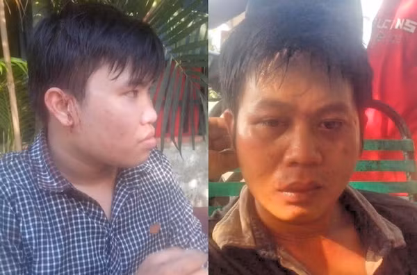 2 phóng viên Vĩnh Phú (phải) và Linh Hoàng (trái) đầy thương tích sau khi bị nhóm côn đồ hành hung (ảnh: Báo Giao thông) 2 phóng viên Vĩnh Phú (phải) và Linh Hoàng (trái) đầy thương tích sau khi bị nhóm côn đồ hành hung (ảnh: Báo Giao thông)