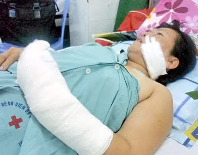 Chân dung bà lão 73 vác dao chém "tình địch" ảnh 1