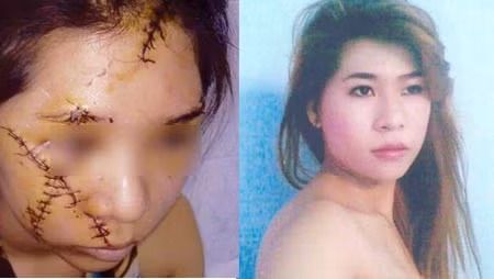 Xử vụ 5 người rạch mặt dã man 1 nữ tiếp viên, An ninh - Hình sự, rach mat, vu an, dao lam, vu an, an mang, trong an, bao, bao cong an, bao an ninh