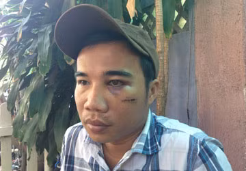 Nạn nhân Nguyễn Nhật Trường với thương tích trên người.