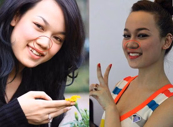 Hà Hoài Thu thẳng thắn thừa nhận mình có làm mũi, nhưng chỉ dừng lại ở đó chứ... không hơn. Mũi của cô giờ thon gọn và cao hơn trước. Ảnh: Internet.