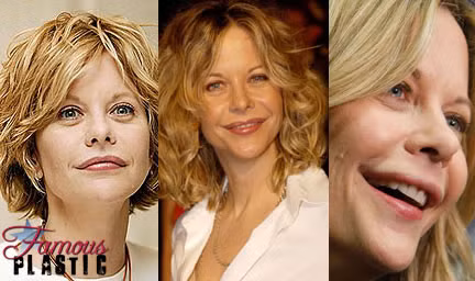 Meg Ryan