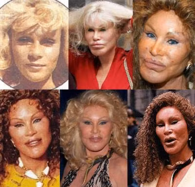 Jocelyn Wildenstein
