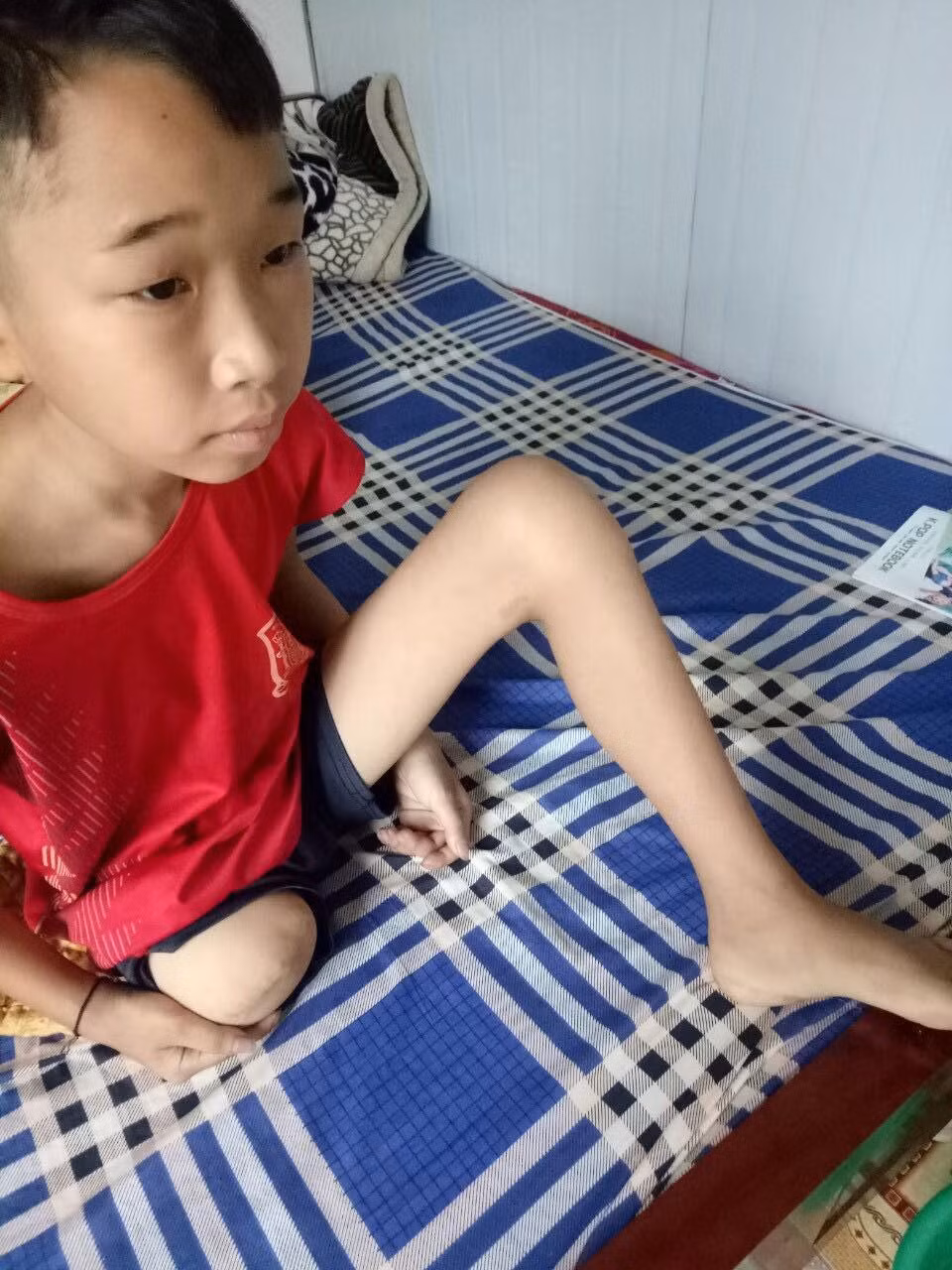 E Lò Văn Dương trong quá trình điều trị tại bệnh viện.