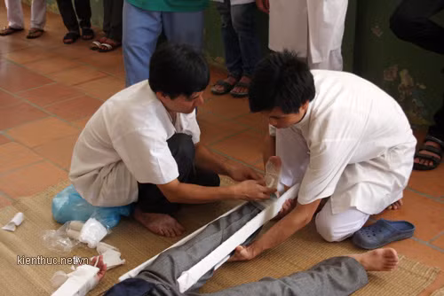 Nếu chân bị gẫy cũng cần cố định lại như cánh tay Nếu chân bị gẫy cũng cần cố định lại như cánh tay