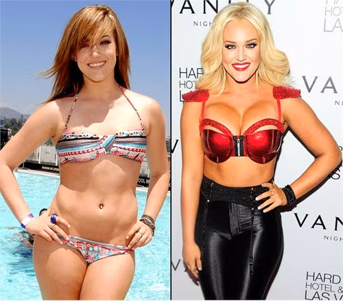Lacey Schwimmer. Ngôi sao của Dancing with the Stars quyết định đi nâng ngực và cô thêm hẳn 2 size - từ vòng ngực B lên tận size D. Rõ ràng sự "tăng trưởng" này không quá lệch tông với cơ thể vốn dĩ khá tròn trịa và đầy đặn của Lacey.
