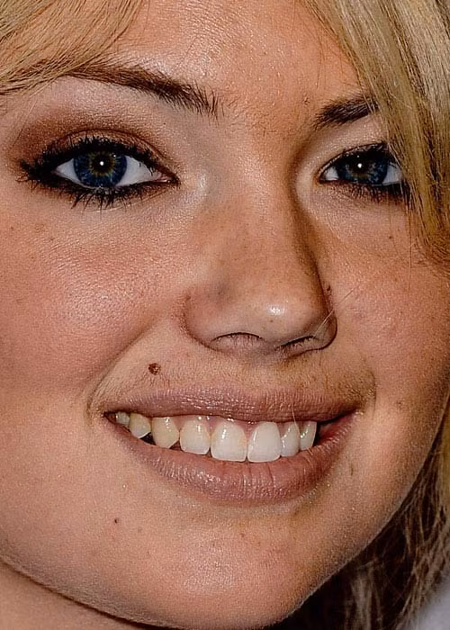 Kate Upton không chỉ để lộ những nốt ruồi "vô duyên" trên khuân mặt, mà có có thể nhìn rất rõ ria mép của cô Xem thêm:Cận cảnh: mặc mộc xinh xắn của Katy Perry