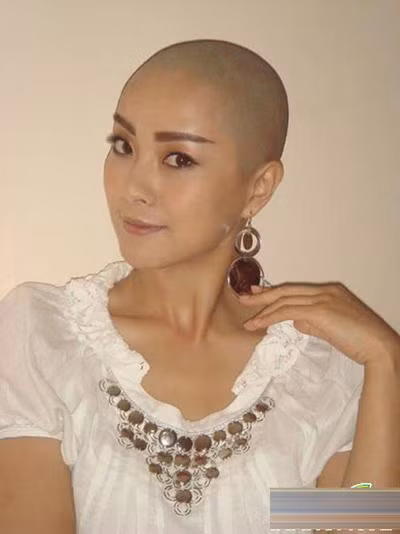 Tô Nham trọc đầu để vào phim “Mỹ nhân đầu trọc”.