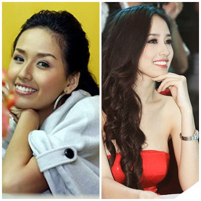 Cũng như trước đó, người ta đã ngỡ ngàng về đủ mọi đường nét biến hóa từ vòng 1 đến làn da, răng, cằm .. của Mai Phương Thúy