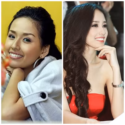 Cũng như trước đó, người ta đã ngỡ ngàng về đủ mọi đường nét biến hóa từ vòng 1 đến làn da, răng, cằm .. của Mai Phương Thúy