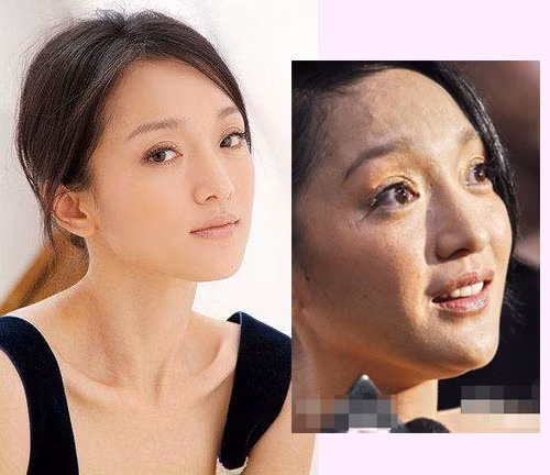 Có thể không tưởng tượng được rằng làn da của người đẹp sở hữu chiếc cằm nhọn cuốn hút lại có thể xấu đến mức độ này, vừa rỗ vừa đen mà không được mịn màng như chúng ta thường thấy. Có vẻ Châu Tấn đã chăm sóc da không đúng cách. Có thể không tưởng tượng được rằng làn da của người đẹp sở hữu chiếc cằm nhọn cuốn hút lại có thể xấu đến mức độ này, vừa rỗ vừa đen mà không được mịn màng như chúng ta thường thấy. Có vẻ Châu Tấn đã chăm sóc da không đúng cách.