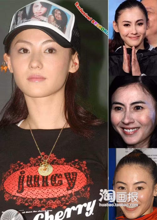 Gương mặt loang lổ, trắng đen không rõ của Trương Bá Chi dù có trang điểm cũng không che được. Gương mặt loang lổ, trắng đen không rõ của Trương Bá Chi dù có trang điểm cũng không che được.