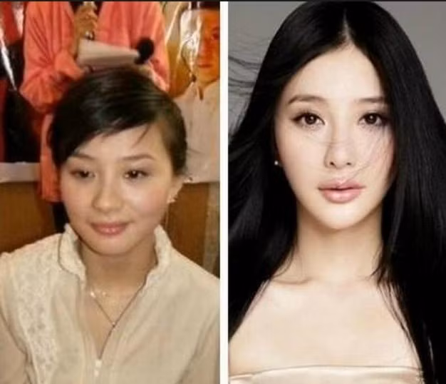 Khuôn mặt của Hùng Nãi Cẩn liệu có phải là khuôn mặt tự nhiên không? Khuôn mặt của Hùng Nãi Cẩn liệu có phải là khuôn mặt tự nhiên không?
