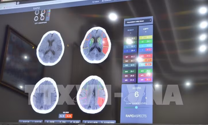 Ảnh minh họa: TTXVN Ảnh minh họa: TTXVN