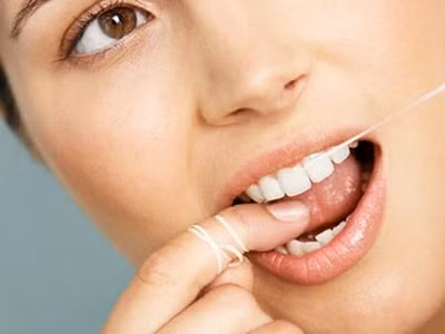 Nên xỉa răng bằng chỉ nha khoa hàng ngày.