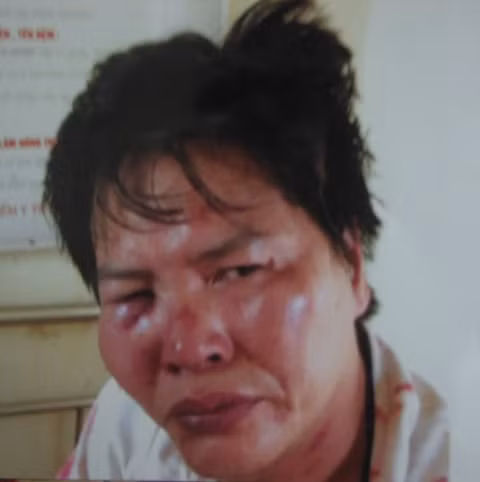 Hình ảnh ông Quang chụp lại hôm xảy ra sự việc ngày 19/6/2011 Hình ảnh ông Quang chụp lại hôm xảy ra sự việc ngày 19/6/2011