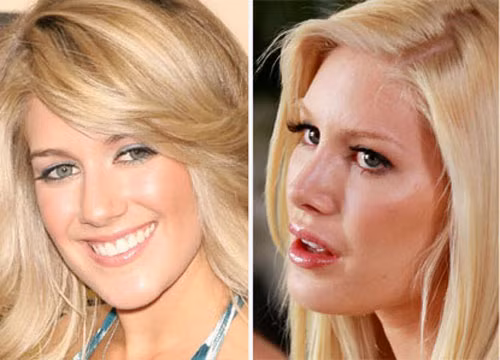 Môi chỉ là một trong số vô vàn lần đụng dao kéo của Heidi Montag. Xem thêm: Sao xấu - Sao đẹp/ Thời trang sao