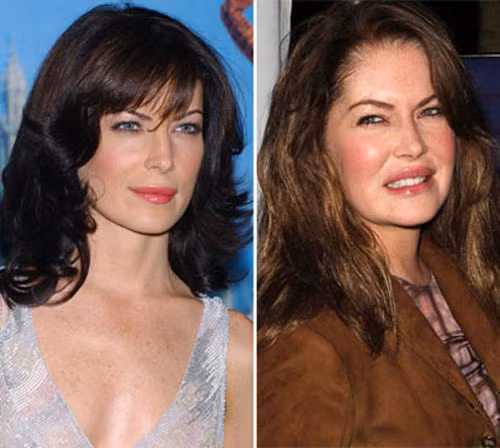Nhìn Lara Flynn Boyle năm 2002 và năm 2010 như hai người khác nhau chỉ bởi vì đôi môi bơm silicon. Xem thêm: Sao xấu - Sao đẹp/ Thời trang sao