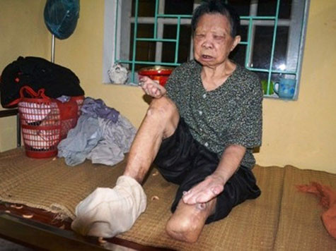 Cụ Vũ Thị Bớt (89 tuổi, xã Dũng Tiến, huyện Thường Tín, TP Hà Nội) chia sẻ với phóng viên Cụ Vũ Thị Bớt (89 tuổi, xã Dũng Tiến, huyện Thường Tín, TP Hà Nội) chia sẻ với phóng viên