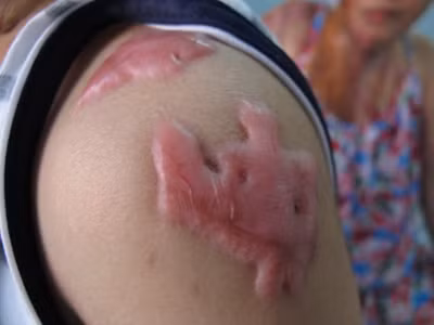 Kẻ tạt axit cả gia đình đi chữa bệnh tâm thần, An ninh Xã hội, tat axit, tam than, tat axit ca nha, mu hai mat, bao, bao cong an, bao an ninh