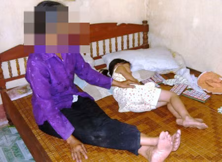 Cháu Na hay bị hoang loạn, thường khóc mỗi khi không có người nhà bên cạnh. Cháu Na hay bị hoang loạn, thường khóc mỗi khi không có người nhà bên cạnh.