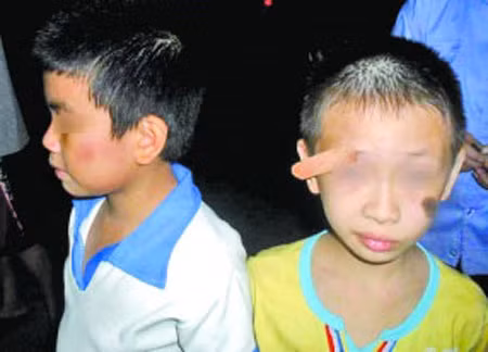 Hai học sinh 8 tuổi bị thầy giáo tát Hai học sinh 8 tuổi bị thầy giáo tát