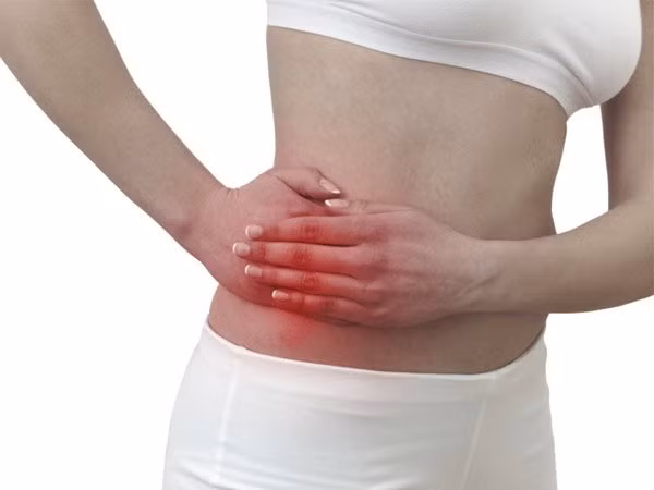 Tất cả những gì bạn cần biết về bệnh viêm ruột ảnh 2