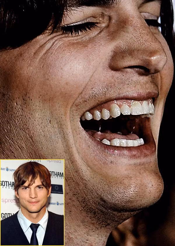 Bạn có còn nghĩ rằng Ashton Kutcher đẹp trai, hoàn hảo? (Ảnh: Xz) Xem thêm: Điểm danh những chiếc cằm mới của Sao Việt / Bộ sưu tập váy xinh chào hè 2012. Bạn có còn nghĩ rằng Ashton Kutcher đẹp trai, hoàn hảo? (Ảnh: Xz) Xem thêm: Điểm danh những chiếc cằm mới của Sao Việt / Bộ sưu tập váy xinh chào hè 2012.