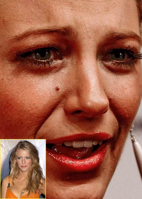 Blake Lively với phần mắt trũng sâu, thâm quầng. (Ảnh: Xz) Xem thêm: Điểm danh những chiếc cằm mới của Sao Việt / Bộ sưu tập váy xinh chào hè 2012. Blake Lively với phần mắt trũng sâu, thâm quầng. (Ảnh: Xz) Xem thêm: Điểm danh những chiếc cằm mới của Sao Việt / Bộ sưu tập váy xinh chào hè 2012.