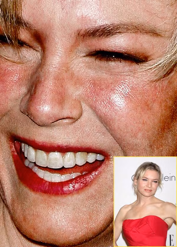 Renee Zellweger giống một bà nội trợ vui vẻ hơn là một ngôi sao. (Ảnh: Xz) Xem thêm: Điểm danh những chiếc cằm mới của Sao Việt / Bộ sưu tập váy xinh chào hè 2012. Renee Zellweger giống một bà nội trợ vui vẻ hơn là một ngôi sao. (Ảnh: Xz) Xem thêm: Điểm danh những chiếc cằm mới của Sao Việt / Bộ sưu tập váy xinh chào hè 2012.