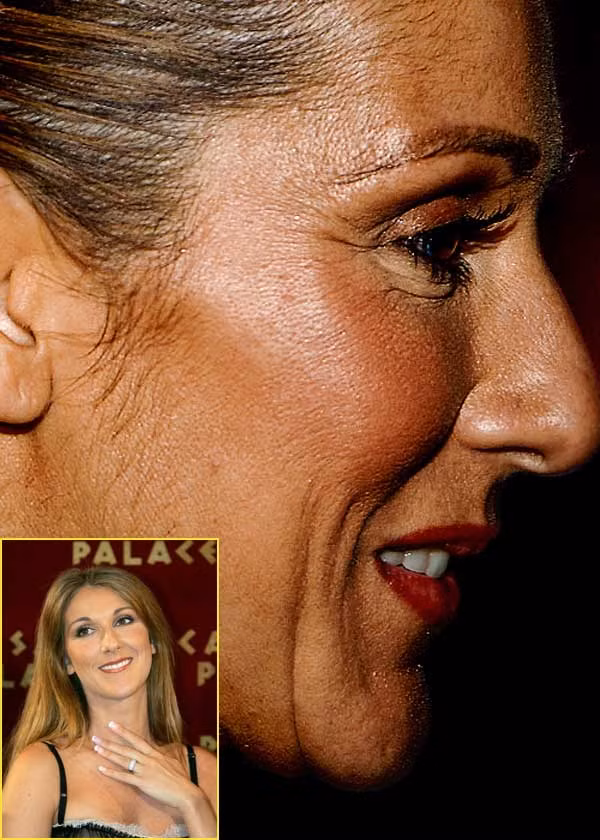 Celin Dion đang chịu sự hành hạ của quá trình lão hóa. (Ảnh: Xz) Xem thêm: Điểm danh những chiếc cằm mới của Sao Việt / Bộ sưu tập váy xinh chào hè 2012. Celin Dion đang chịu sự hành hạ của quá trình lão hóa. (Ảnh: Xz) Xem thêm: Điểm danh những chiếc cằm mới của Sao Việt / Bộ sưu tập váy xinh chào hè 2012.
