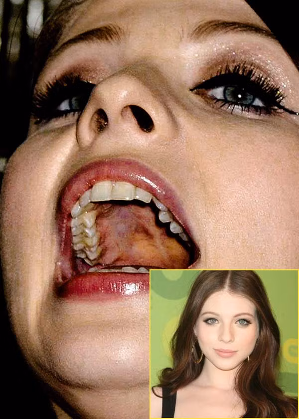 Chân dung cận cảnh của Michelle Trachtenberg. Trông khác xa so với hình ảnh bóng bẩy, mỹ miều thường thấy. (Ảnh: Xz) Xem thêm: Điểm danh những chiếc cằm mới của Sao Việt / Bộ sưu tập váy xinh chào hè 2012. Chân dung cận cảnh của Michelle Trachtenberg. Trông khác xa so với hình ảnh bóng bẩy, mỹ miều thường thấy. (Ảnh: Xz) Xem thêm: Điểm danh những chiếc cằm mới của Sao Việt / Bộ sưu tập váy xinh chào hè 2012.
