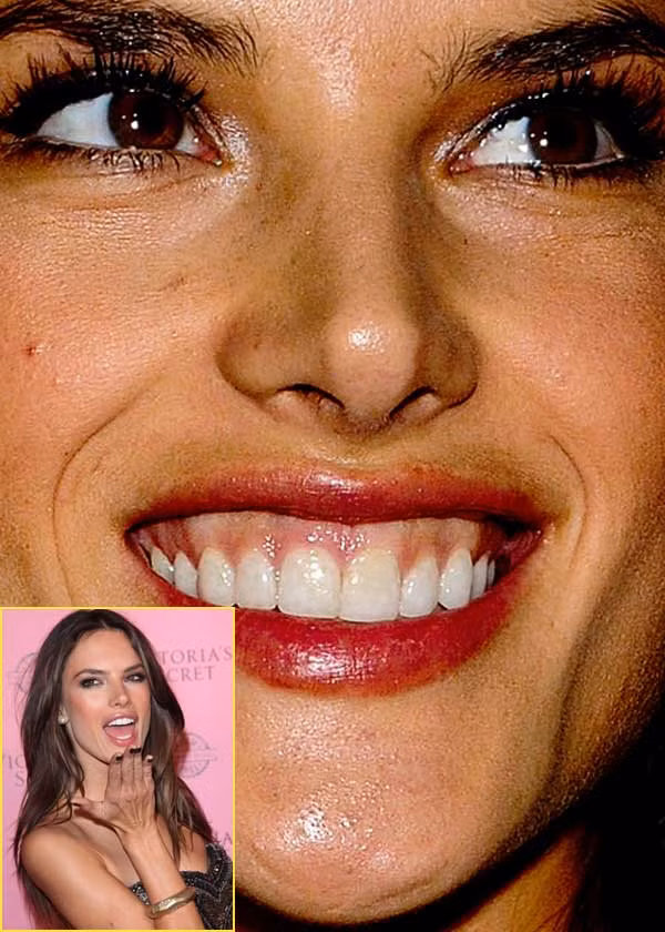Thiên thần Victoria's Secret Alessandra Ambrosio là người đẹp hiếm hoi không khiến fan phải "đau tim" từ góc nhìn cận. (Ảnh: Xz) Xem thêm: Điểm danh những chiếc cằm mới của Sao Việt / Bộ sưu tập váy xinh chào hè 2012. Thiên thần Victoria's Secret Alessandra Ambrosio là người đẹp hiếm hoi không khiến fan phải "đau tim" từ góc nhìn cận. (Ảnh: Xz) Xem thêm: Điểm danh những chiếc cằm mới của Sao Việt / Bộ sưu tập váy xinh chào hè 2012.