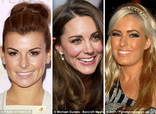 Kiểu 4: Lông mày đậm màu Desperate Scousewives, Coleen Rooney và nữ công tước Kate Middleton là đại diện cho kiểu lông mày thời trang này. Xem thêm: Điểm danh những chiếc "cằm mới" của Sao Việt.