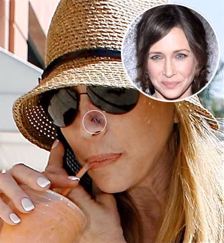 Ngôi sao Up in the Air, Vera Farmiga cũng bị nghi nâng mũi khi cô bị bắt gặp rời khỏi phòng khám của một bác sĩ ở Beverly Hills với một vết thâm tím. Tuy nhiên, nữ diễn viên đã khăng khăng vết tím đó là do cô va đập trên phim trường. Xem thêm: Bằng chứng tố Angela Baby cậy nhờ dao kéo để xinh đẹp. Ngôi sao Up in the Air, Vera Farmiga cũng bị nghi nâng mũi khi cô bị bắt gặp rời khỏi phòng khám của một bác sĩ ở Beverly Hills với một vết thâm tím. Tuy nhiên, nữ diễn viên đã khăng khăng vết tím đó là do cô va đập trên phim trường. Xem thêm: Bằng chứng tố Angela Baby cậy nhờ dao kéo để xinh đẹp.