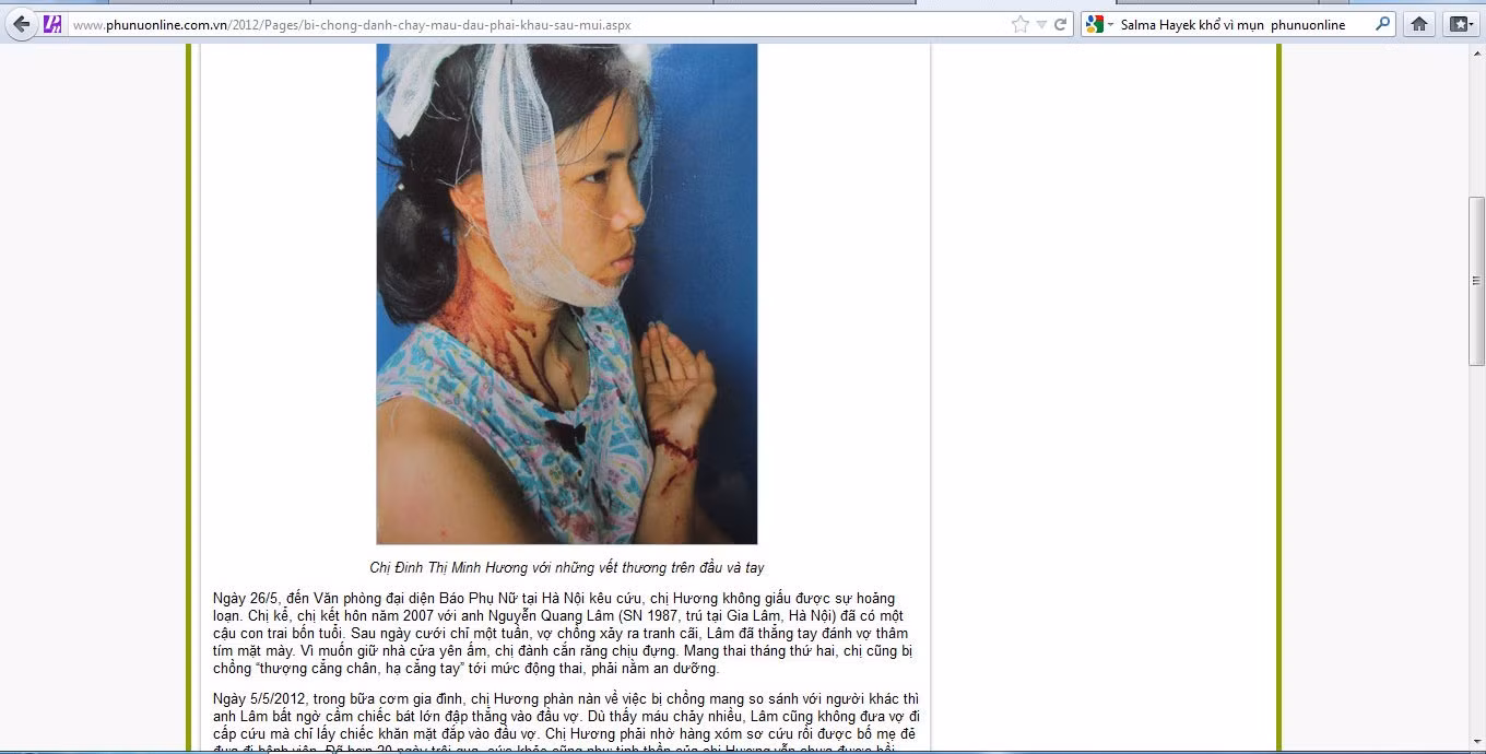 Chuyên mục Thời sự- xã hội ngày 30/5/2012 đăng tin “Bị chồng đánh chảy máu đầu, phải khâu sáu mũi” với hình ảnh máu me phản cảm