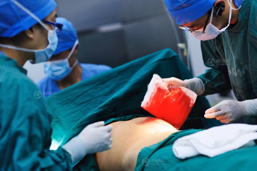 Từng vạt da trên cơ thể người cha được lấy ra để cứu con gái tội nghiệp, máu hồng thấm ướt tấm khăn. Từng vạt da trên cơ thể người cha được lấy ra để cứu con gái tội nghiệp, máu hồng thấm ướt tấm khăn.
