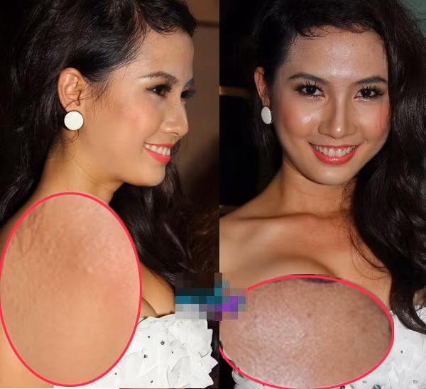 Phan Thị Mơ mất điểm vì làn da bóng nhẫy và sần sùi. Phan Thị Mơ mất điểm vì làn da bóng nhẫy và sần sùi.