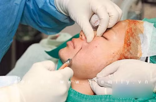 Bác sĩ đang tiến hành hút mỡ, chỉnh mặt và nâng mông, nâng ngực cho Trần Duy Thiên Bác sĩ đang tiến hành hút mỡ, chỉnh mặt và nâng mông, nâng ngực cho Trần Duy Thiên