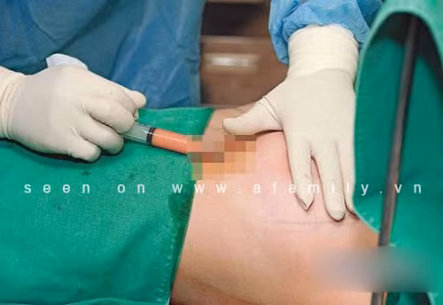 Trần Duy Thiên tâm sự: “Phẫu thuật xong, phần ngực của tôi bị thâm tím rất kinh khủng. Tôi đau đớn toàn thân. Chỉ đi bộ thôi, tôi đã thấy được nỗi đau đó tệ hại như thế nào. Các bác sĩ cho biết có thể phẫu thuật sẽ để lại sẹo mờ còn đau đớn sẽ thuyên giảm trong vòng một tuần. 3 ngày sau đại phẫu, tôi bắt đầu trở lại trường học. Dù gì tôi vẫn phải đảm bảo việc học tập của mình. Giờ, tôi có thể tự hào nói rằng tôi rất đẹp.”. Trần Duy Thiên tâm sự: “Phẫu thuật xong, phần ngực của tôi bị thâm tím rất kinh khủng. Tôi đau đớn toàn thân. Chỉ đi bộ thôi, tôi đã thấy được nỗi đau đó tệ hại như thế nào. Các bác sĩ cho biết có thể phẫu thuật sẽ để lại sẹo mờ còn đau đớn sẽ thuyên giảm trong vòng một tuần. 3 ngày sau đại phẫu, tôi bắt đầu trở lại trường học. Dù gì tôi vẫn phải đảm bảo việc học tập của mình. Giờ, tôi có thể tự hào nói rằng tôi rất đẹp.”.