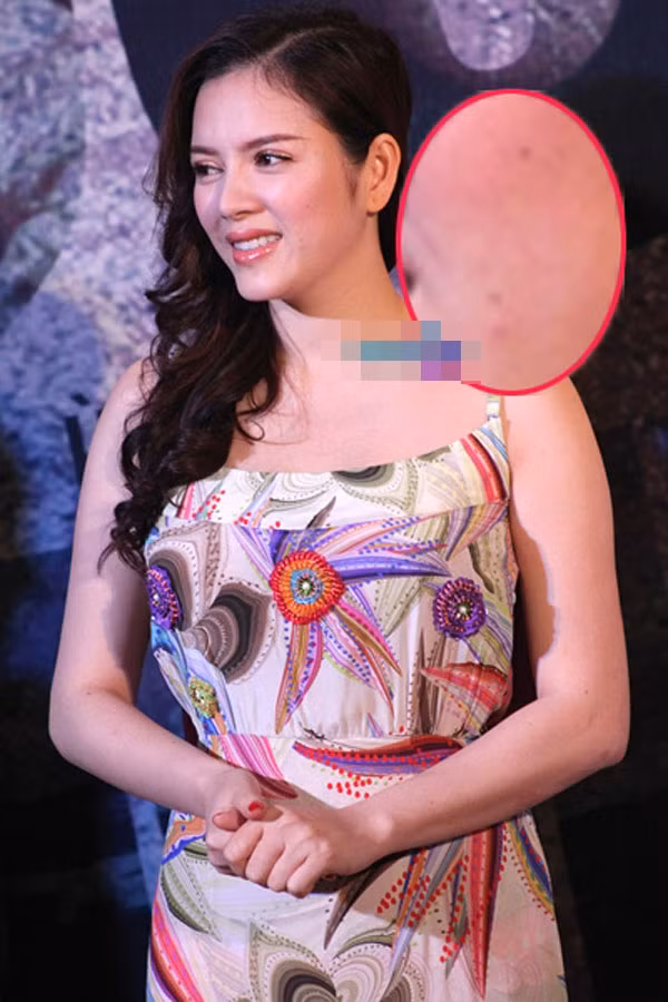 Nếu để ý kỹ sẽ thấy những vết thâm trên má của Lý Nhã Kỳ. Nếu để ý kỹ sẽ thấy những vết thâm trên má của Lý Nhã Kỳ.