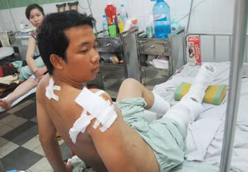 Anh Duy đang điều trị tại BV Đa khoa khu vực Thủ Đức.