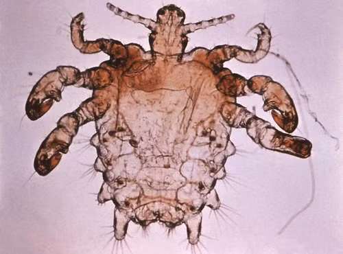Rận mu.