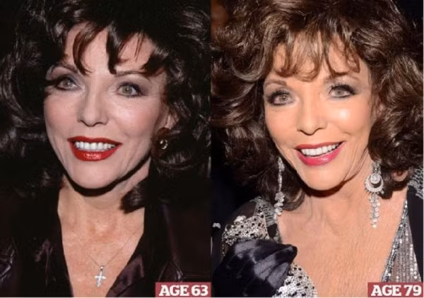 Minh tinh người Anh Joan Collins năm 63 tuổi và 79 tuổi.