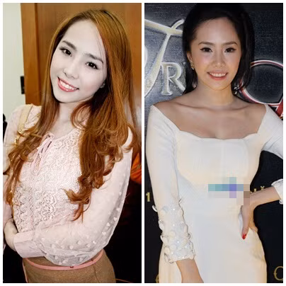 Khuôn mặt như bị phù này khiến đôi mắt của Quỳnh Nga thiếu linh hoạt, các nét trên khuôn mặt cũng theo đó mà trở nên gượng gạo.